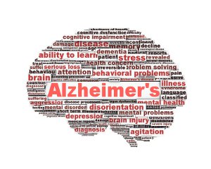 Alzheimer Brain